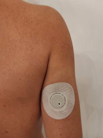 Датчик мониторинга глюкозы Оттай м8. CGM Ottai M8